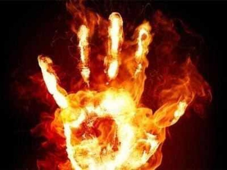 दिवाली पर पड़ोसी के पटाखों से 10 माह की बच्ची जली,मुकदमा दर्ज